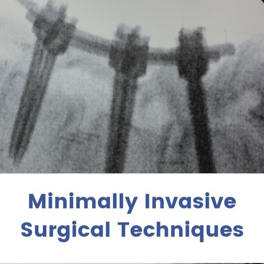 Invasive surgical techniques